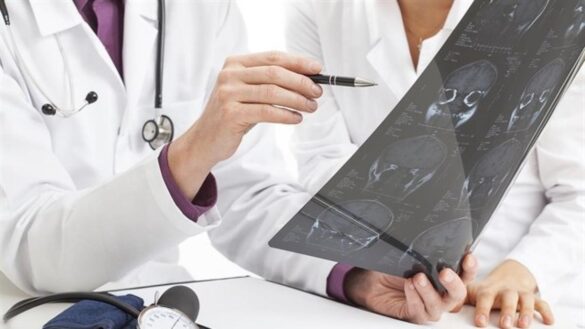 desarrollan-una-nueva-herramienta-basada-en-una-proteina-para-predecir-la-evolucion-de-los-pacientes-tras-un-ictus