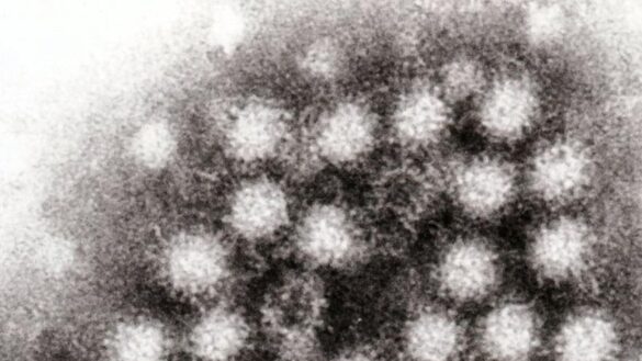 peligros-de-los-norovirus:-son-resistentes-a-los-detergentes,-al-estres-ambiental-y-a-la-desinfeccion-con-rayos-uv