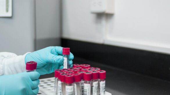 desarrollan-un-nuevo-analisis-de-sangre-que-puede-diagnosticar-el-nivel-de-depresion