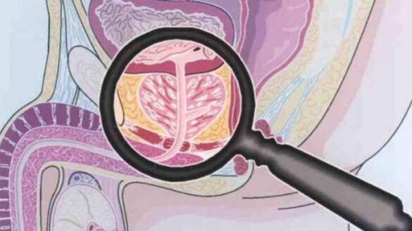 crean-un-sistema-para-detectar-en-segundos-el-cancer-de-prostata