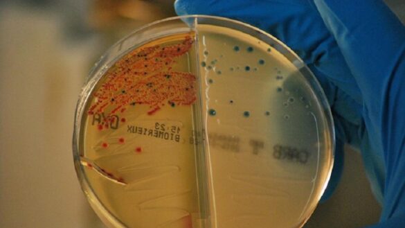 que-son-las-‘superbacterias’,-que-causan-700.000-muertes-al-ano,-y-que-esta-haciendo-la-ciencia-para-combatirlas