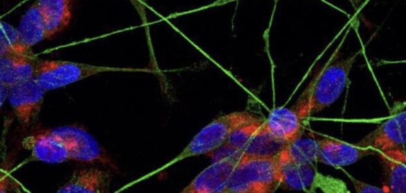 los-astrocitos-explican-por-que-la-covid-provoca-a-veces-trastornos-neuronales