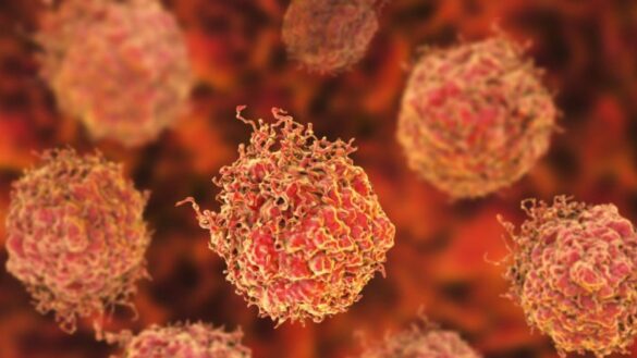 cientificos-hallan-una-terapia-que-puede-ser-definitiva-contra-el-cancer-de-prostata