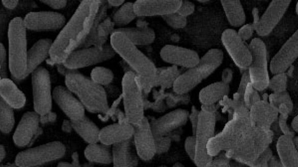 el-problema-de-salud-que-causara-10-millones-de-muertes-en-2050-si-no-lo-remediamos
