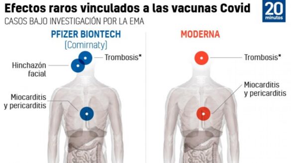 estos-son-todos-los-efectos-raros,-reacciones-y-sindromes-vinculados-a-las-vacunas-covid-que-investiga-la-ema