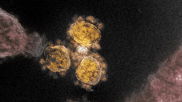 ¿que-es-el-sindrome-inflamatorio-multisistemico?-y-¿como-se-relaciona-con-la-covid-19?