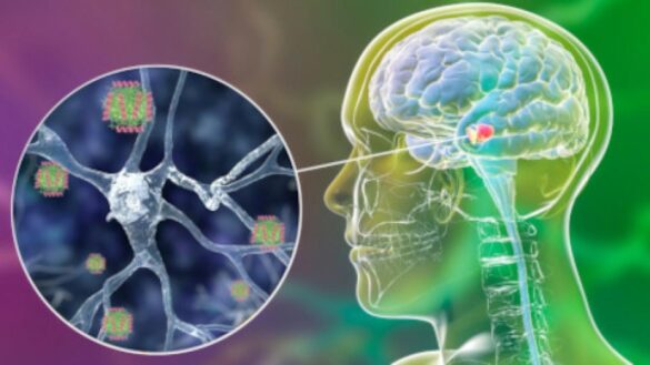encuentran-una-molecula-que-bloquea-las-formas-toxicas-de-la-proteina-que-da-paso-al-parkinson
