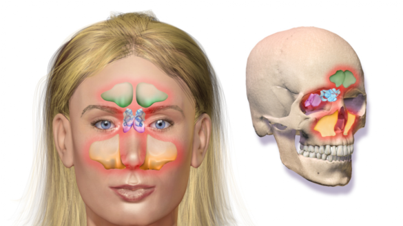 ¿crees-que-tienes-sinusitis?-estos-son-los-sintomas,-causas-y-tratamiento