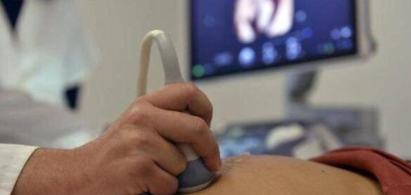 igualdad-endurecera-la-objecion-medica-para-asegurar-abortos-en-centros-publicos