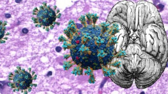 asocian-la-covid-con-un-aumento-de-biomarcadores-del-alzheimer-en-sangre