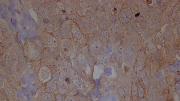 investigadores-del-csic-estudian-uno-de-los-mecanismos-desencadenantes-fundamentales-de-la-metastasis