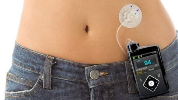 la-falta-de-formacion,-principal-barrera-para-implementar-la-telemedicina-en-el-tratamiento-de-la-diabetes