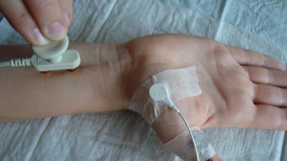 el-implante-cerebral-que-devuelve-el-tacto-en-los-dedos-a-los-pacientes-con-neuropatia-periferica
