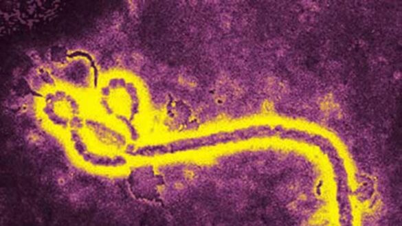 investigadores-espanoles-logran-eliminar-tumores-cerebrales-usando-un-virus-de-los-ratones