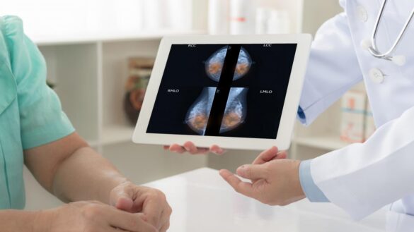 las-mamografias,-las-mejores-aliadas-contra-el-cancer-de-mama