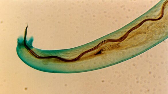 ¿que-es-la-meningitis?-estos-son-sus-sintomas,-sus-causas-y-su-tratamiento