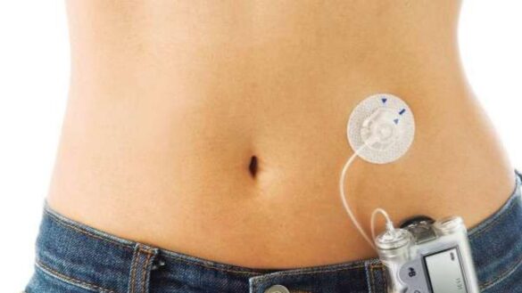 sensores,-moviles-conectados,-bombas-de-insulina…-como-la-tecnologia-puede-ayudar-a-las-personas-con-diabetes