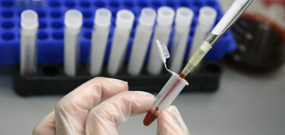 identifican-a-un-segundo-paciente-cuyo-cuerpo-se-ha-deshecho-del-vih