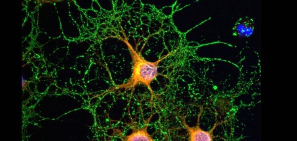descubren-el-mecanismo-de-estabilizacion-de-las-neuronas