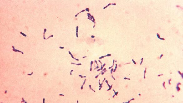 ¿que-es-la-difteria?-estos-son-sus-sintomas,-sus-causas-y-su-tratamiento