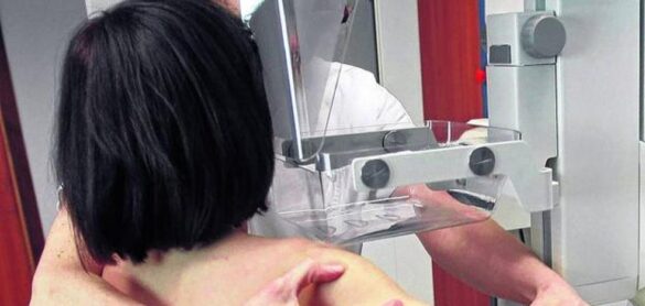 nuevo-farmaco-contra-el-cancer-de-mama-mas-agresivo