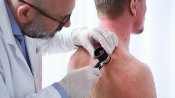 cuando-la-dermatitis-atopica-persiste-en-la-adolescencia:-«existe-un-elevado-riesgo-de-ansiedad-y-depresion»