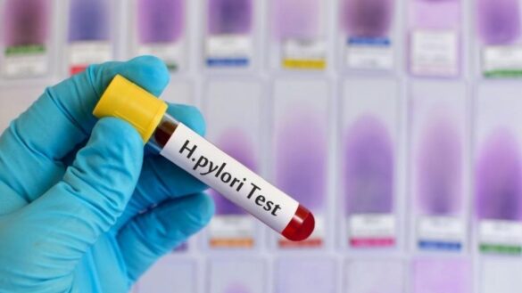el-helicobacter-pylori-tiene-una-gran-resistencia-a-los-antibioticos