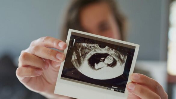 problemas-con-el-cordon-umbilical:-como-actua-el-doctor-si-se-enrolla-en-el-cuello-del-bebe