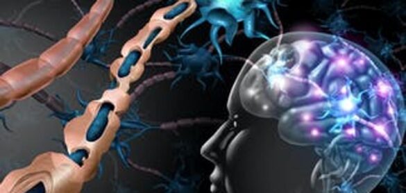 esclerosis-multiple:-asi-‘mordisquea’-el-sistema-inmunitario-nuestra-conexion-neuronal