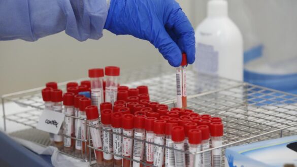 investigadores-espanoles-disenan-un-test-para-detectar-la-covid-en-la-saliva