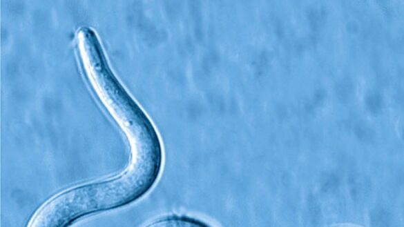 ¿que-es-la-elefantiasis?-estos-son-sus-sintomas,-sus-causas-y-su-tratamiento