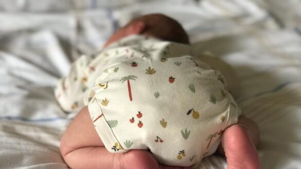 estos-son-los-sintomas-de-la-onfalitis-o-infeccion-umbilical-del-recien-nacido