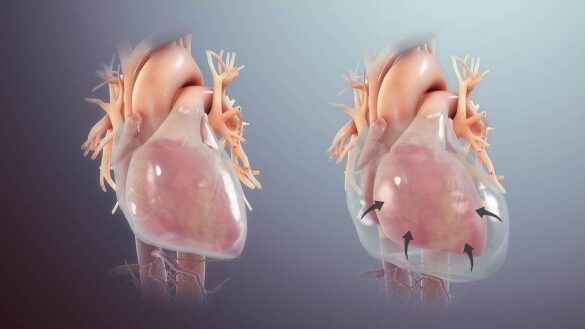 tos,-mareos-y-otros-sintomas-de-la-pericarditis:-que-es,-causas-y-tratamiento