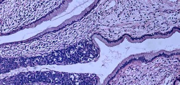 ¿esta-recomendada-para-mujeres-adultas-la-vacuna-contra-el-cancer-de-cuello-de-utero?