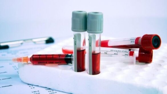 un-nuevo-analisis-de-sangre-detecta-cancer-en-personas-con-sintomas-que-suelen-pasar-desapercibidos
