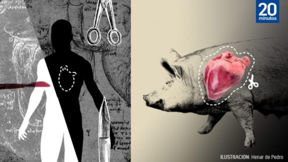 el-esperanzador-trasplante-de-corazon-de-cerdo-a-humano-y-la-lucha-contrarreloj-ante-el-riesgo-a-un-«rechazo-genetico»