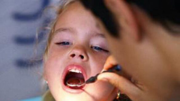 ¿deben-tratarse-las-caries-de-los-dientes-de-leche?