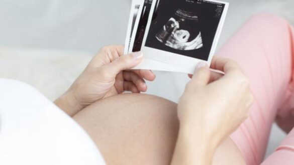 un-analisis-de-sangre-puede-predecir-la-preeclampsia-antes-de-que-aparezca