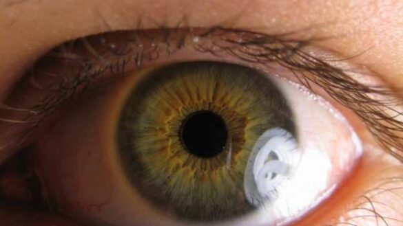 ¿que-es-la-uveitis?-estos-son-sus-sintomas,-sus-causas-y-su-tratamiento