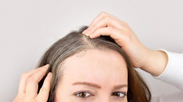 ¿surgen-con-el-estres?-¿se-pueden-prevenir?…-mitos-sobre-las-canas