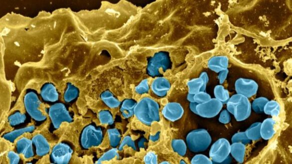 en-que-consiste-la-tularemia,-una-peligrosa-infeccion-que-pueden-transmitir-nuestras-mascotas