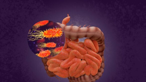 permeabilidad-intestinal:-que-es-y-como-tratar-sus-alteraciones-con-probioticos-y-alimentacion