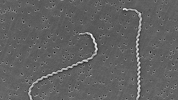 como-identificar-la-leptospirosis,-una-infeccion-potencialmente-grave-que-transmiten-los-perros-a-las-personas