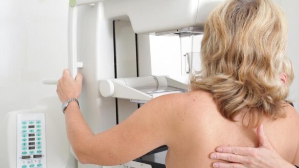 un-nuevo-farmaco-contra-el-cancer-de-mama-logra-frenar-la-metastasis