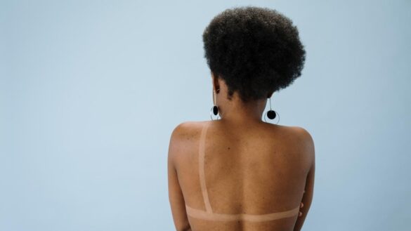 que-debes-saber-de-la-radioterapia-despues-de-la-mastectomia:-sesiones-y-efectos-secundarios