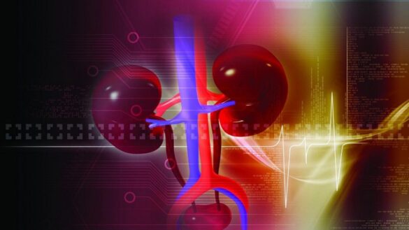 850-millones-de-personas-en-el-mundo-sufren-algun-tipo-de-enfermedad-en-los-rinones,-asi-puedes-cuidar-tu-salud-renal