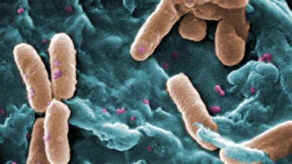 terapia-personalizada-con-antibioticos,-una-nueva-via-para-vencer-bacterias-resistentes