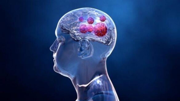 nuevo-avance-contra-el-cancer:-la-terapia-que-permite-tratar-tumores-resistentes
