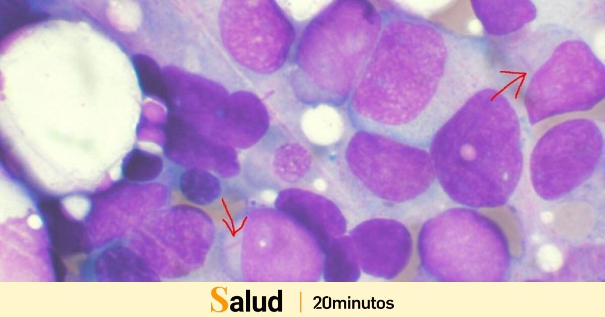 Nace una cátedra en Barcelona dedicada a investigar la inmunoterapia celular, eficaz contra algunos tipos de cáncer