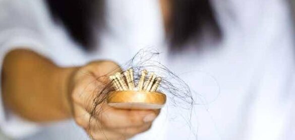 las-mujeres-tambien-sufren-la-alopecia:-estos-son-los-mejores-tratamientos